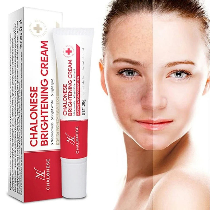 Chalonese Brightening Cream | Buy 1 Get 1 Free