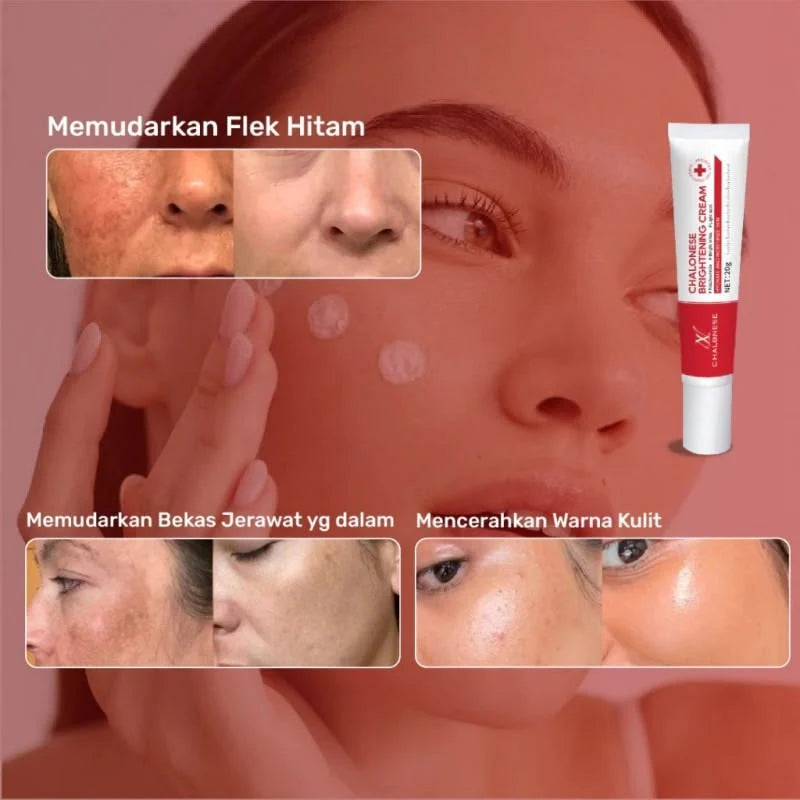 Chalonese Brightening Cream |  Buy 1 Get 1 Free