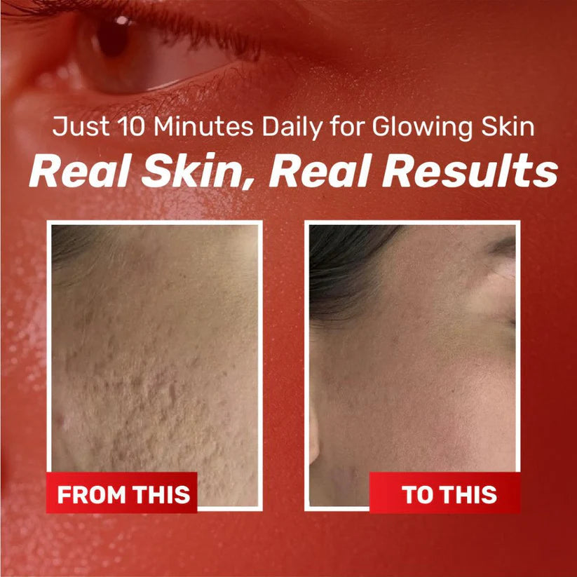 Chalonese Brightening Cream |  Buy 1 Get 1 Free
